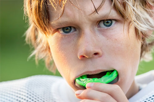 Don’t Take to the Field Without a Custom Mouthguard