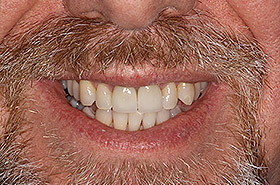Image for 