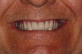 Image for 